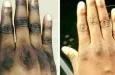 Alerte Sanitaire : liste des 139 produits cosmétiques de dépigmentation interdits au Bénin